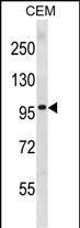 WB - PGR Antibody (Center) AP19838c